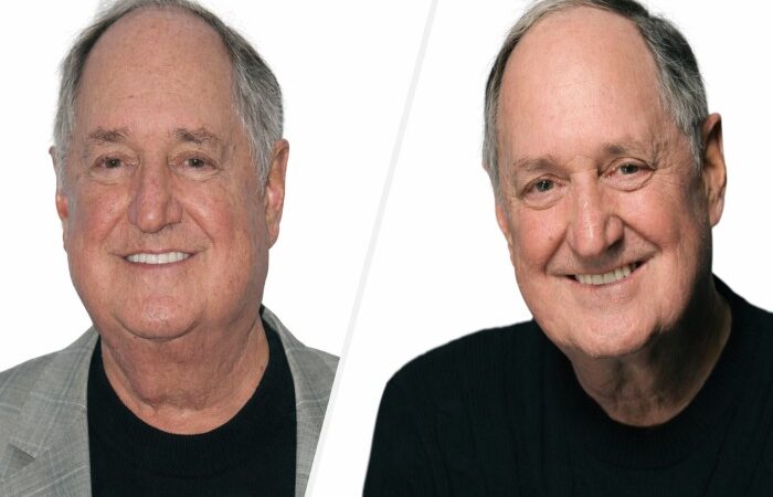 Neil Sedaka cause of death