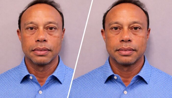 Tiger Woods Arrests