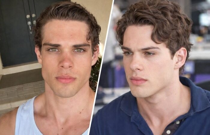 Clavicular Overdose Hospitalized