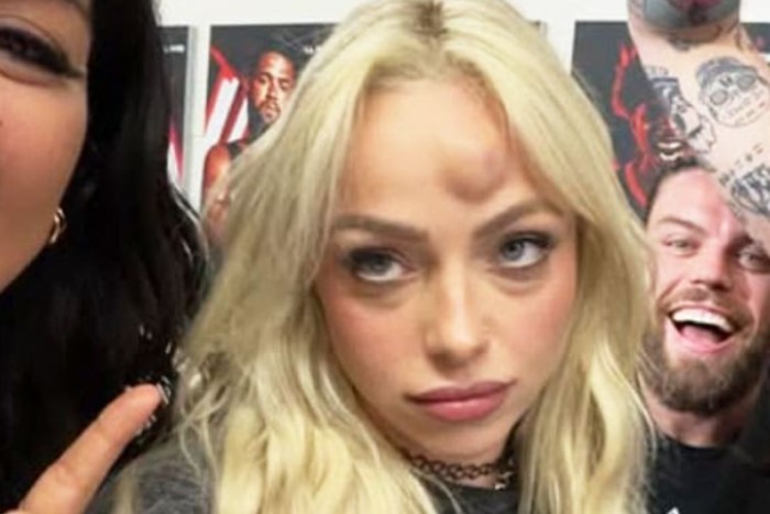 Liv Morgan Injury